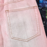 ACNE