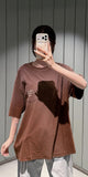 ACNE