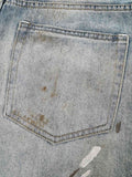 ACNE