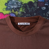 ACNE
