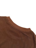 ACNE