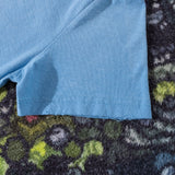 ACNE