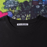 ACNE