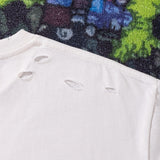 ACNE