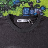 ACNE