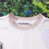 ACNE