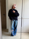 ACNE