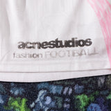 ACNE