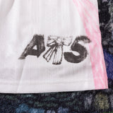 ACNE