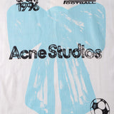 ACNE