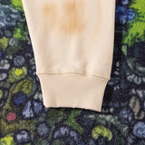 ACNE
