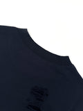 ACNE