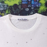 ACNE