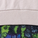 ACNE